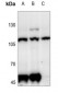 Anti-CD229 Antibody