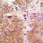 Anti-TAK1 Antibody