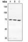 Anti-TAK1 Antibody