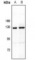 Anti-MYBPC1 Antibody