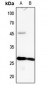 Anti-MYL3 Antibody