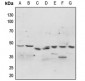Anti-p47 phox (pS304) Antibody