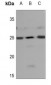 Anti-NDUFB9 Antibody