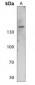 Anti-NFAT3 (pS676) Antibody