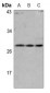 Anti-pro-NGF beta Antibody