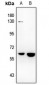 Anti-NR4A3 Antibody