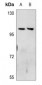 Anti-Neuropilin 2 Antibody