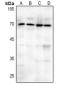 Anti-CD73 Antibody