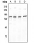 Anti-PNPLA6 Antibody