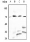 Anti-PPP2R5D Antibody