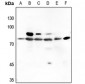 Anti-PKC beta Antibody