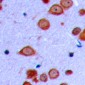 Anti-PRKD2 (pS876) Antibody