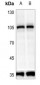 Anti-PRKD2 (pS876) Antibody