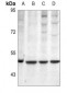 Anti-Protein C Antibody