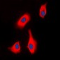 Anti-PTHR1 Antibody