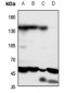 Anti-PTHR1 Antibody