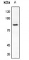 Anti-RAD17 Antibody