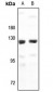 Anti-G15 Antibody