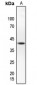 Anti-hnRNP G Antibody