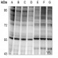 Anti-NF-kappaB p65 (pT254) Antibody