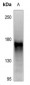 Anti-RET (pY1062) Antibody