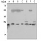 Anti-RPL18 Antibody