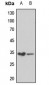 Anti-RPS6 (pS240) Antibody