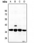 Anti-RPS6 Antibody