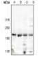 Anti-Nogo Antibody