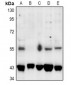 Anti-SGK1/2 (pT256/253) Antibody