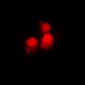 Anti-SIAH2 Antibody