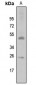 Anti-SIAH2 Antibody