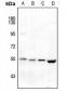 Anti-MCT4 Antibody