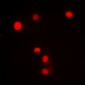 Anti-SP1 (pT453) Antibody