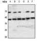 Anti-Tachykinin Receptor 1 Antibody