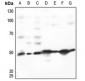 Anti-TACSTD2 Antibody