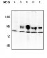 Anti-TBX3 Antibody