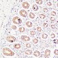Anti-Thrombospondin 2 Antibody