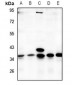 Anti-TMBIM1 Antibody