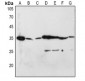 Anti-CD253 Antibody