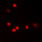 Anti-p53 (AcK319) Antibody