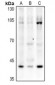 Anti-p53 (AcK319) Antibody