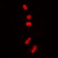 Anti-p53 (AcK381) Antibody