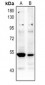 Anti-p53 (AcK381) Antibody
