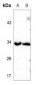 Anti-TRADD Antibody