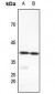 Anti-FX Antibody