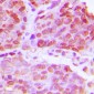 Anti-TTF1 Antibody