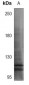 Anti-TTF1 Antibody