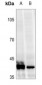 Anti-VDR (pS208) Antibody