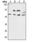 Anti-VIPR1 Antibody